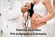 Toxemia gravídica pré eclampesia e eclampsia